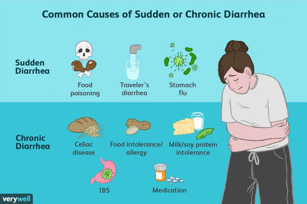 What Is Diarrhea?